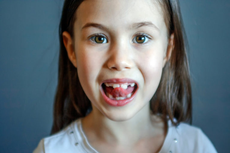 Tongue In-and-Outs speech therapy at home