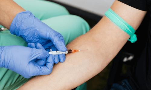 Phlebotomy procedure with a close-up view of a patient's arm, showing a needle inserted for blood collection and a medical device in the background