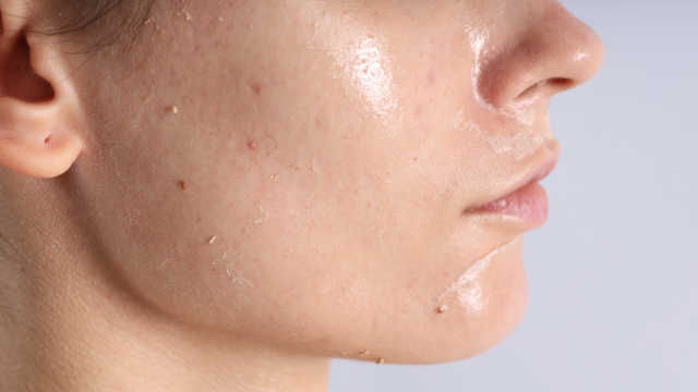 Dermatology & Skin Anatomy