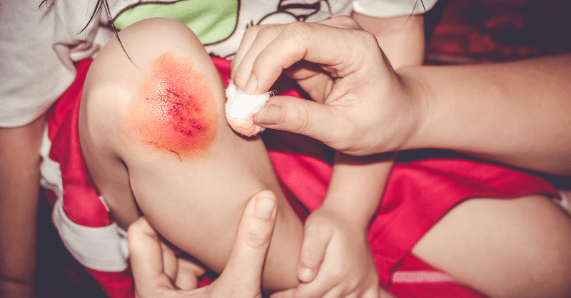 CHILDRENS-FIRST-AID-FOR-CUTS